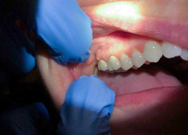 Best Emergency Dental Surgery in Vaville, CA