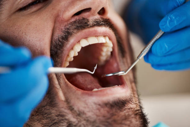 Best After-Hours Emergency Dentist in Vaville, CA